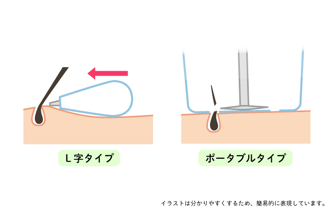 肌に優しい「フェイスシェーバー」。L字タイプとポータブルタイプの説明図